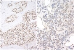 PQBP1 Antibody, Novus Biologicals 0.1mL; Unlabeled:Antibodies, Polyclonal